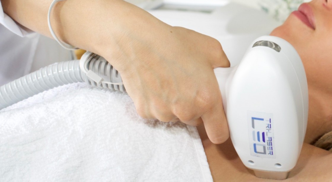 Este verano, cuida tu piel con la depilación láser indolora de 360Clinics