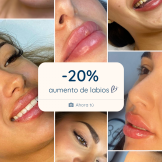 360º CLINICS: 20% EN AUMENTO DE LABIOS